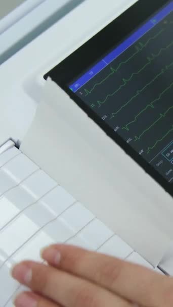 Cardiograma Cardíaco Nas Mãos Médico Close Cardiologista Está Estudando Testemunho — Vídeo de Stock