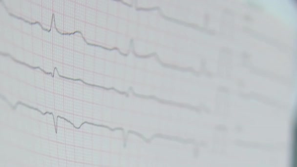 Srdeční Kardiogram Rukou Lékaře Zblízka Kardiolog Studuje Svědectví Elektrokardiografu — Stock video