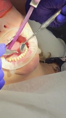 En son diş temizleme teknolojisi, hemşire ve doktor hastaların dişlerini tedavi ediyor. Alt dişleri temizliyorum. Doktorların yüzlerinde koruyucu maskeler, eldivenler, temizlik ve temizlik. 4k