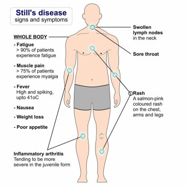 Yetişkin başlangıcı. Hala hastalığın belirtileri ve belirtileri.