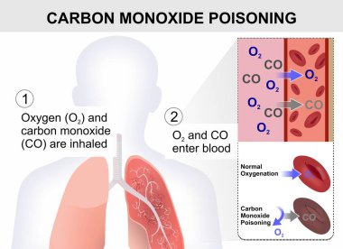 Karbon Monoksit Zehirleme Çizim Sorumlusu Kanlı