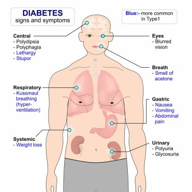 Belirtiler ve diyabet belirtileri