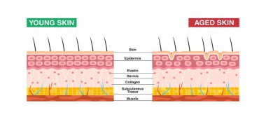 Yaşlanma süreci. Genç ve yaşlı cilt karşılaştırması. Genç ve yaşlı ciltlerde kolajen, elastin ve fibroblastlar.