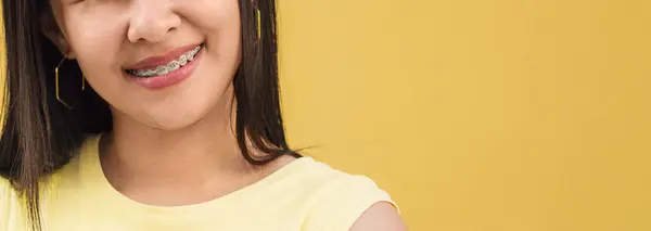 Healthy smile with braces over yellow background.