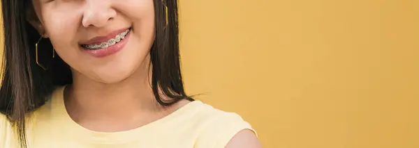 Dişlerinde diş teli olan tanınmayan genç bir kadın. diş konsepti.