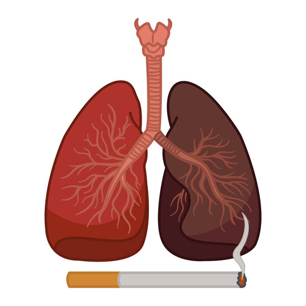 Healthy Lung and Smoker's Lung. The danger of smoking on the human respiratory system. Lungs cancer. Vector Illustration of Human Internal Organs