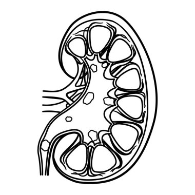 Renklendirme için böbrek taşlarının anatomisi. İdrar yolu hastalığının tıbbi konsepti. İnsan İç Organlarının Vektör İllüstrasyonu