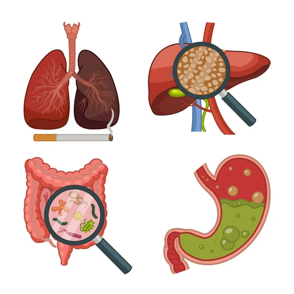 Anatomía Órganos Humanos Con Diversas Enfermedades Ilustración Vectorial Pulmones Fumador — Vector de stock