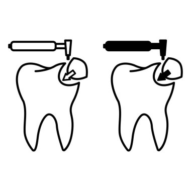 Diş Doldurma simgeleri. Siyah ve Beyaz Vektör Simgeleri. Parçalanmış bir dişin birleşik dolgusu ile restorasyonu. Diş bakımı ve tedavi. Tıp ve Diş Hekimliği Konsepti