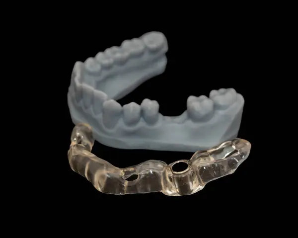 3Dプリント手術ガイド ロイヤリティフリーのストック画像