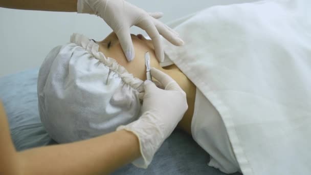 Hautbehandlung Mit Der Dermaplaning Technik Die Mit Einem Skalpell Von — Stockvideo