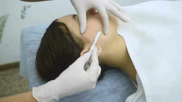 Hautbehandlung Mit Der Dermaplaning Technik Die Mit Einem Skalpell Von — Stockvideo