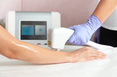 Güzellik salonunda ellerin lazerle kesilmesi. Lazer tüy çıkarma teknolojisi kullanarak el kılı çıkarma prosedürü.