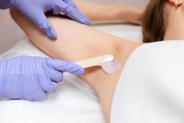 Güzellik salonunda koltuk altı ağdası prosedürü. Eldiven ustası, bir kadının koltuk altına kıllarını çıkarmak için tahta bir spatulayla balmumu sürer. Vücut bakımı kavramı.