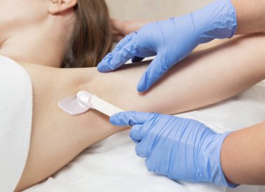 Güzellik salonunda koltuk altı ağdası prosedürü. Eldiven ustası, bir kadının koltuk altına kıllarını çıkarmak için tahta bir spatulayla balmumu sürer..