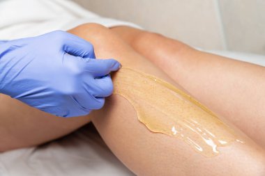 Güzellik salonunda ayak şekerleme prosedürü. Eldiven ustası tüy dökmek için bir kadının bacağına şeker yapıştırıcısı sürer..