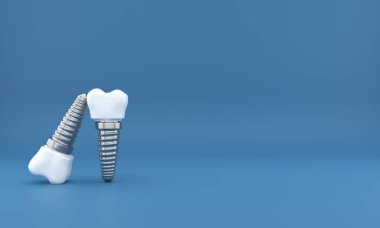 Diş implantı ameliyatı 3D görüntüleme