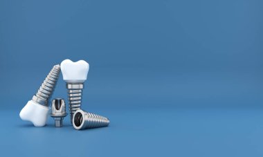 dental implants surgery 3d rendering clipart
