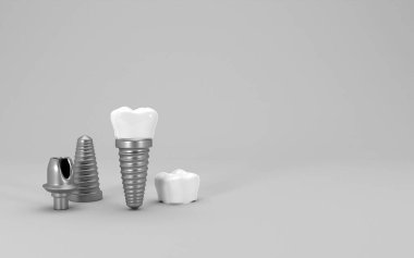 Diş implantı ameliyatı 3D görüntüleme