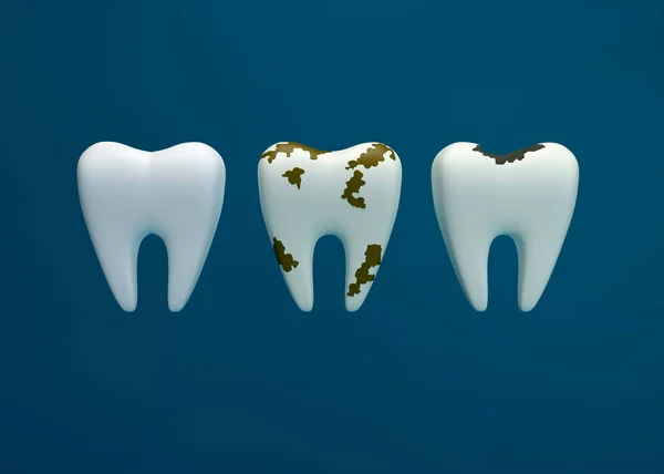 Photo tooth decay bad tooth dental care background unhealthy teeth