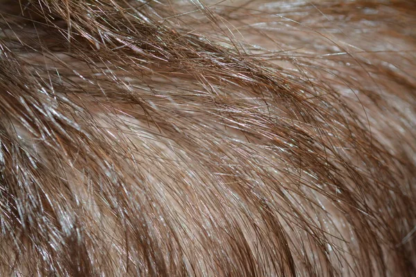 Macro photography of hairs