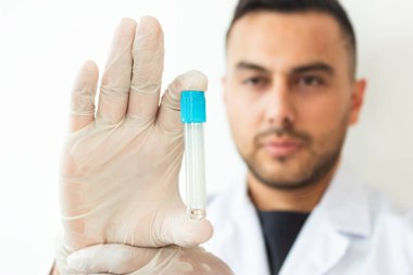 Neiva-Huila-Kolombiya 'daki bir klinikteki Kolombiyalı bir doktorun elindeki kan tüpü. Sağlık kavramı