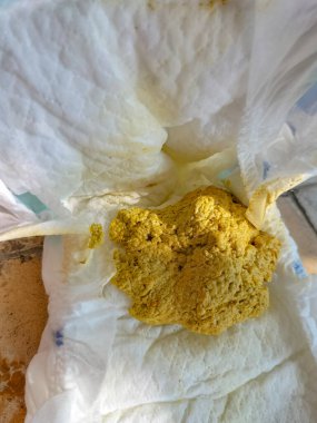 Yeni doğmuş bebeğin kakası ve kirli kokulu bebek bezinin yakın çekimi. Kirli bebek bezi dolu..