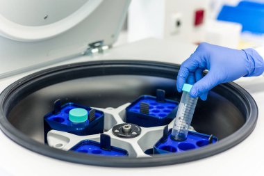 Eldivenli el dikkatli bir şekilde test tüpünü modern bir bilim laboratuarının içindeki santrifüje yerleştiriyor. Kesin tıbbi ve bilimsel araştırma ve analiz ile meşgul oluyor.