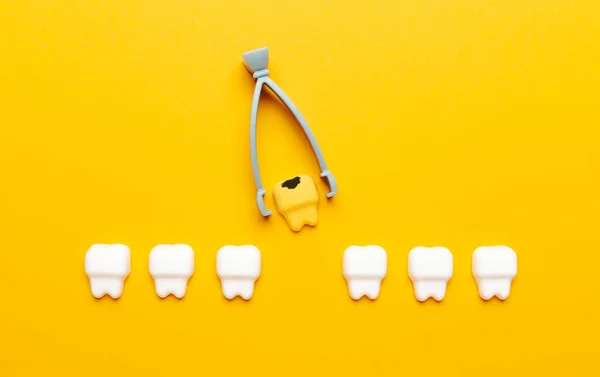 Extração Dentes Leite Cirurgia Dos Dentes Das Crianças Conceito — Fotografia de Stock