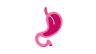 Gastrik bant mide boyutunu, eğitim amaçlı veya tıbbi amaçlar için ayarlıyor