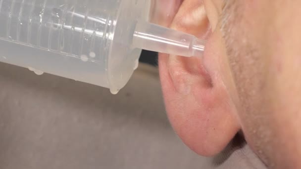 Closer Look Ear Rinsing Procedure Man Using Syringe Warm Water — Stock Video