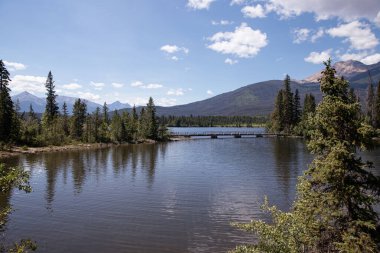 Jasper Ulusal Parkı 'ndaki Dağ Gölü, Alberta, Kanada. 
