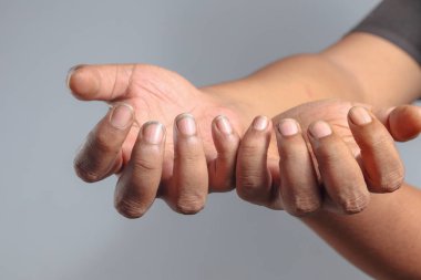 Kirli tırnaklar, iki eli açık, bir jest istemek için öne doğru uzanıyor.