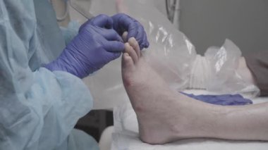 Ayak hastalıkları uzmanı yaşlı bir hastanın tırnaklarını temizliyor. Çivi ve tırnak temizliği. Yüksek kalite 4k görüntü