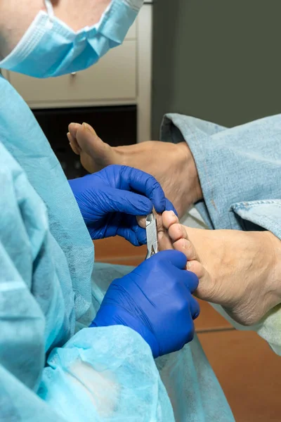 Ayak Hastalıkları Uzmanı Klinikte Bir Müşterinin Tırnaklarını Kesmek Için Kerpeten — Stok fotoğraf
