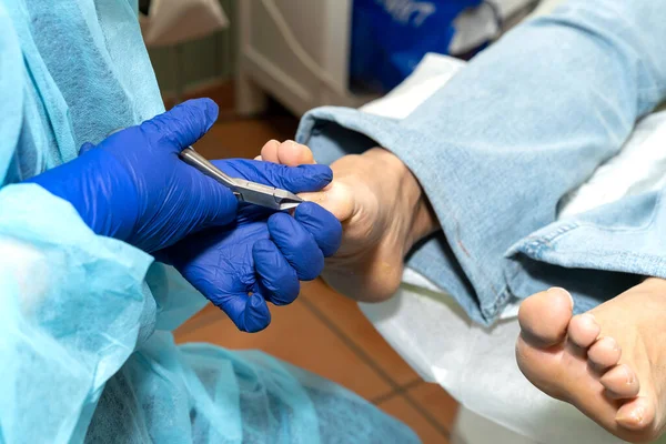 Podiatrist Demonstrates Her Skill Trimming Patients Nails Wellness Feet High — Stock Photo, Image
