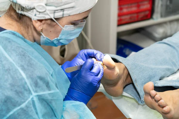 Podólogo Limpia Cuidadosamente Las Uñas Los Pies Sus Pacientes Tratamiento — Foto de Stock