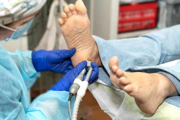Ортопед Использует Медицинскую Доску Удаления Сухой Кожи Пятки Ноги Пациента Лицензионные Стоковые Изображения