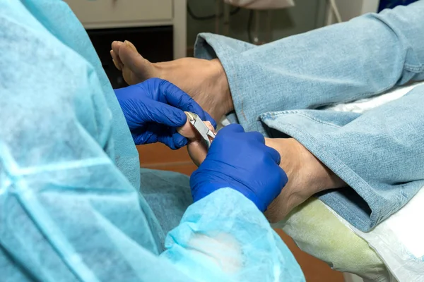Podiatrist Uses Pair Pliers Cut Clients Nails Clinic Concept Hygiene — Stock Photo, Image