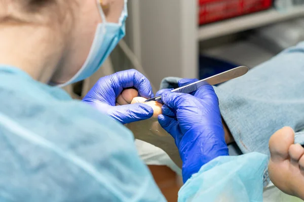 Podiatrist Carefully Cleans Her Patients Toenails Nail Treatment Podiatrist Attending — Stock Photo, Image