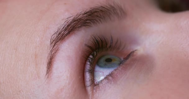 Wanita Menjatuhkan Obat Tetes Mata Mata Tetes Mata Perawatan Mata — Stok Video