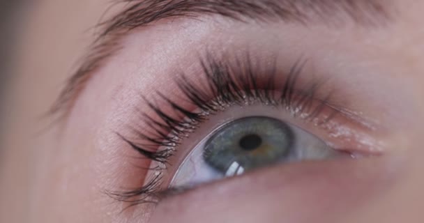 Mulher Deixar Cair Colírios Médicos Olho Colírio Cuidados Com Olhos — Vídeo de Stock