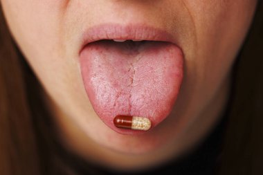 Hap alan genç bir kadın. Dilinde tabletle kadın ağzı kapanıyor.