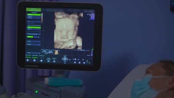 Ekranda Gösterilen Bir Bebeğin Yüzü Ultrason Taramasıyla Elde Edildi Görüntüler — Stok video