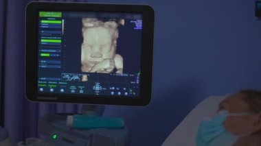 Ekranda gösterilen bir bebeğin yüzü, ultrason taramasıyla elde edildi. Bu görüntüler, doğmamış çocuğun modern çağın mucizesini gözler önüne seren detaylı özelliklerine bir göz atma imkanı sunuyor.