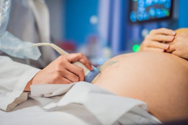 Hastanede, Doktorun Yakın Çekimi Hamile Bir Kadın 'a Ultrason Sonogram Prosedürü uyguluyor. Kadın Doğum Uzmanı Geleceğin Annesinin Göbeğinde Transdüktör Taşımacısı.