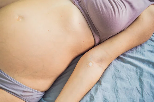 Jinekoloji Kliniğindeki Hamile Bir Kadının Kan Tahlilinden Sonra Kolunda Yapıştırıcı — Stok fotoğraf