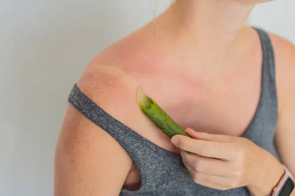 妊娠中の自然な救済を受け入れ アロエの葉で日焼けした肌をソーセージ — ストック写真
