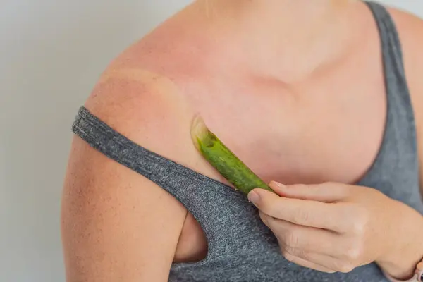 妊娠中の自然な救済を受け入れ アロエの葉で日焼けした肌をソーセージ — ストック写真