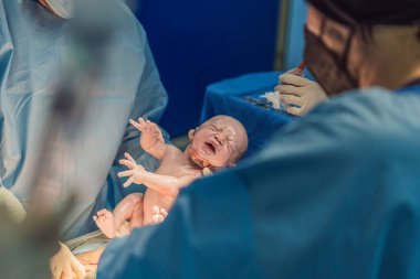 Bir bebek sezaryen sırasında doğuyor. Cerrahi prosedür steril bir ameliyathanede, hem anne hem de bebeğin güvenliğini sağlamak için yetenekli bir tıbbi ekiple yürütülüyor..